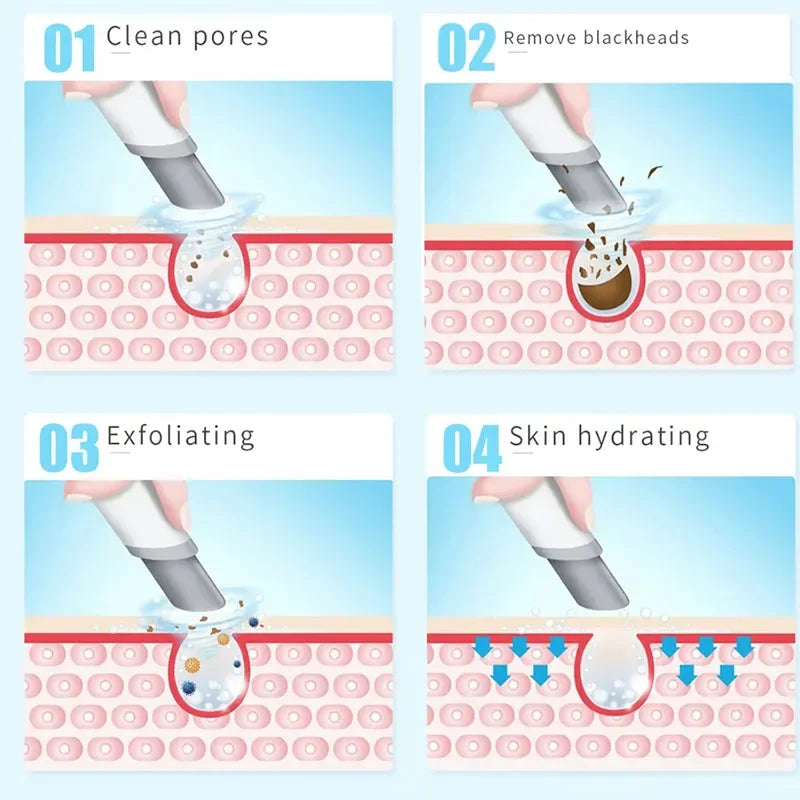 NEW Peeling Beauty Device New Small Bubble Oxygen Injection Instrument Hydra Dermabrasion Aqua Facial Cleaning Suction Blackhead